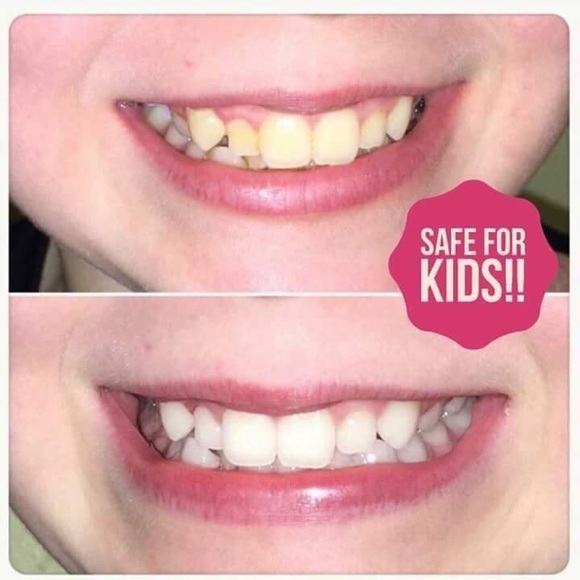 Toothpaste - Picture 5 of 7